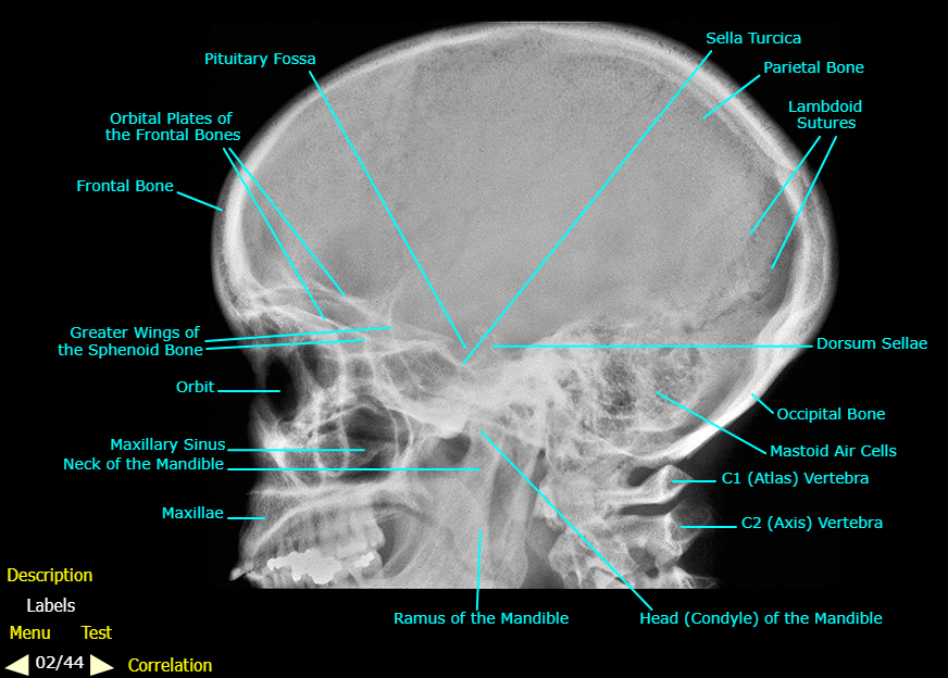 <ol><li><p>Pituitary Fossa</p></li><li><p>Orbital Plates of the Frontal Bones</p></li><li><p>Frontal Bone</p></li></ol><p></p>