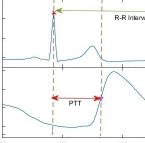 <p>time it takes from ventricular depolarization to contraction causing pulse pressure</p>