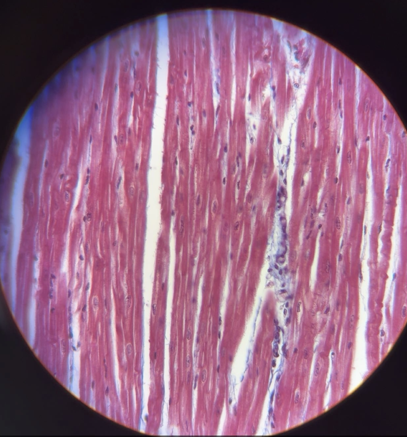 <ul><li><p class="p1"><strong><u>Description</u></strong>: Branching, striated, generally uninucleate cells that connect at specialized junctions (intercalated discs).</p></li></ul><p class="p1"></p><ul><li><p class="p1"><strong><u>Function</u></strong>: As it contracts, it propels blood into the circulation; involuntary control.</p></li></ul><p class="p1"></p><ul><li><p class="p1"><strong><u>Location</u></strong>: The walls of the heart.</p></li></ul><p></p>