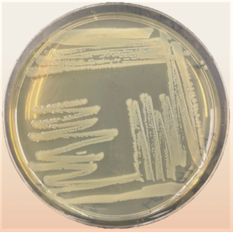 <p>Which of the following is the most likely explanation for what you see on the isolation streak plate?</p>