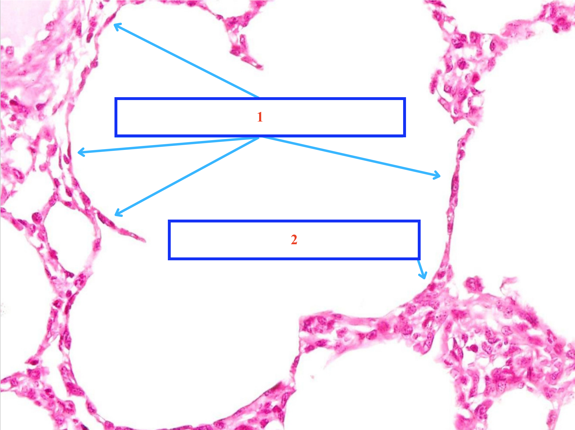 <p>Tế bào gì ?</p>