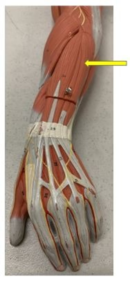 <p>extends wrist and adducts hand</p>