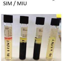 <p>Bepaalt of de bacterie het enzym tryptofaanase bezit.</p><ul><li><p>Tryptofaanase zet het aminozuur tryptofaan om in indool, pyruvaat en ammoniak → desaminatie en verdere afsplitsing van zijketens totdat indool overblijft</p></li><li><p>Medium bevat tryptofaan (bvb. SIM, MIU) </p></li><li><p>Na incubatie wordt het Kovacs-reagens toegevoegd → reageert met indool </p></li><li><p>Indoolpostief → rode ring aan de oppervlakte </p></li><li><p>Indoolnegatief → de laag blijft geel/bruin </p></li></ul><p></p>