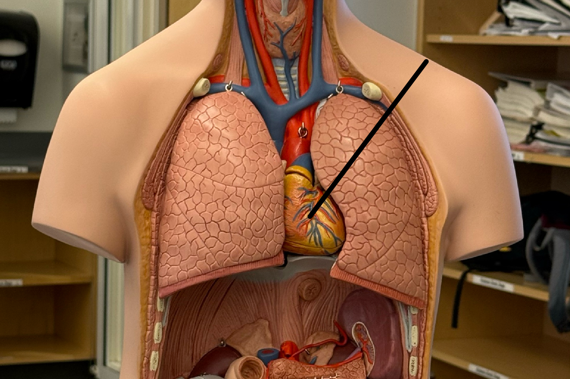 <p>A hollow, muscular organ that pumps blood throughout the body.</p>