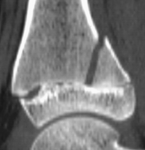 <p>What is the diagnosis?</p>