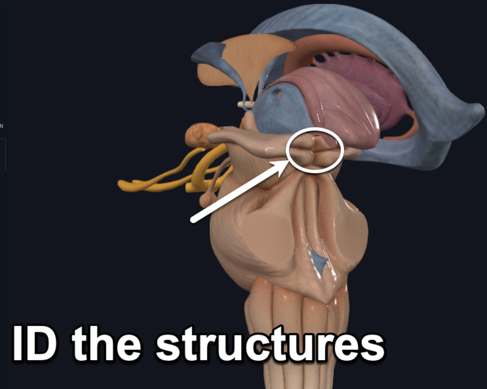 term image