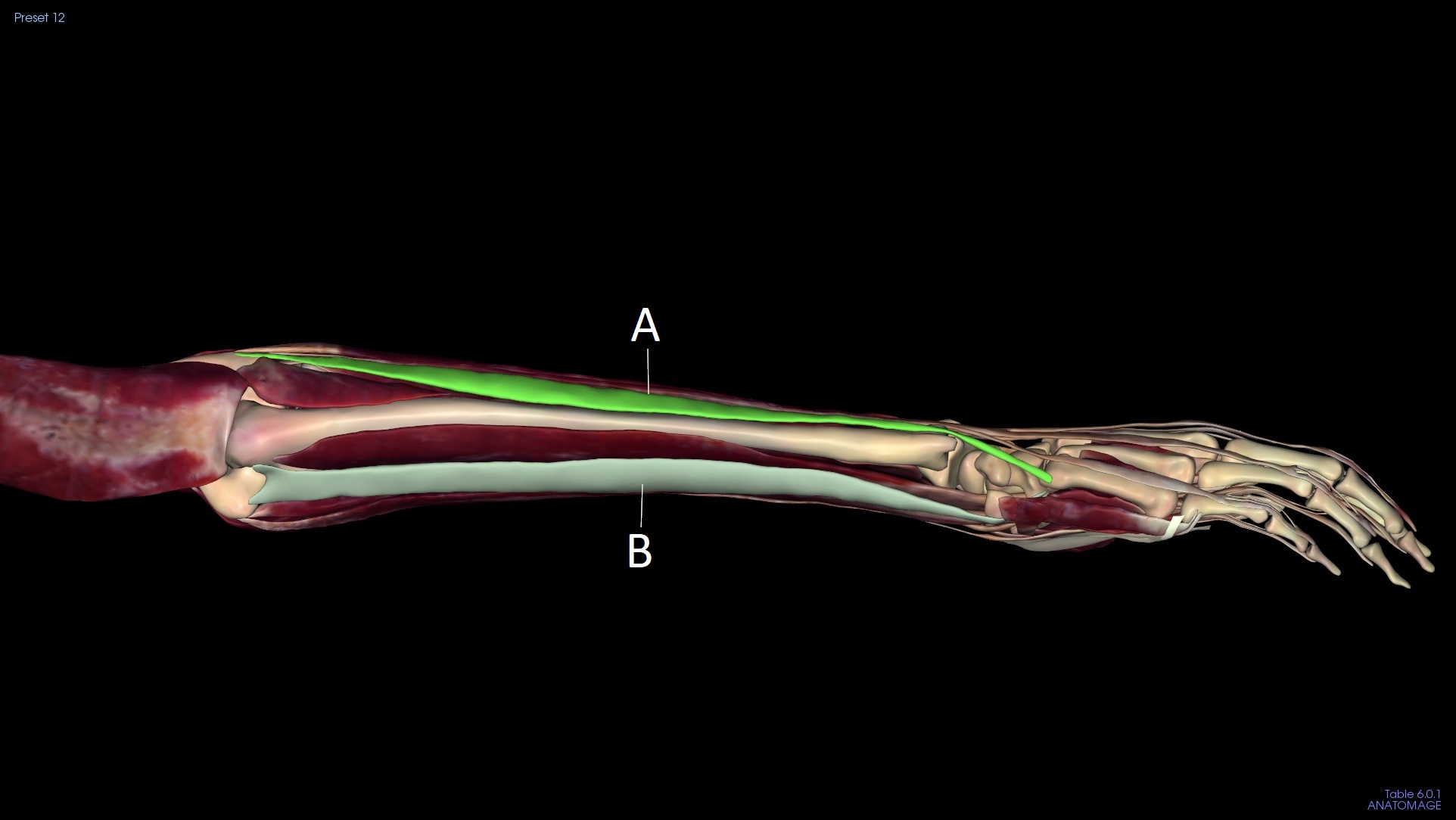 <p>A</p>