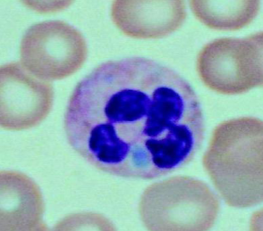 <p>What neutrophilic change is present here? What is the blue dot made of?</p>