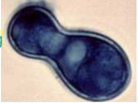 <p>what fungus is shown in the image?</p>