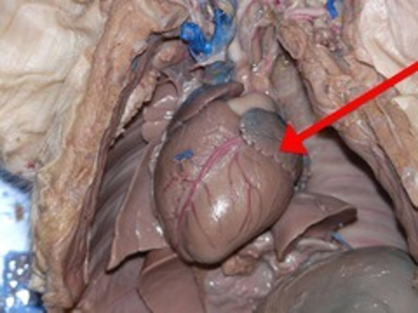 <p>(under the auricle)</p>