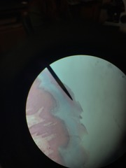 <p>Uppermost layer of the epidermis</p><p>Dead keratin-filled cell "horny layer"</p><p>25-30 layers of dead cells filled with keratin</p><p>"Stratified squamous epithelium"</p>