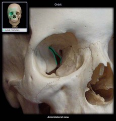 <p>cranial cavity</p>