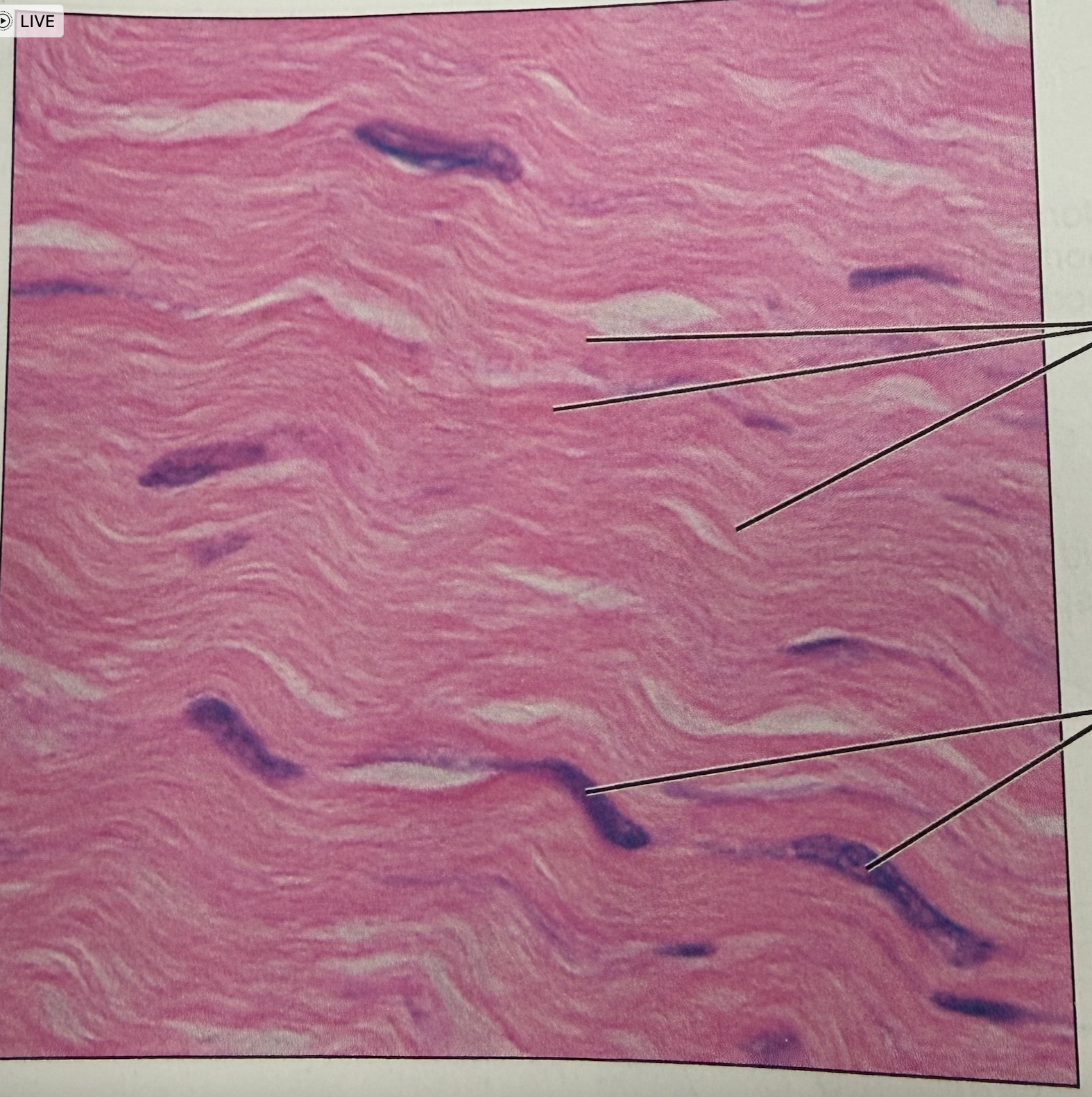 <p>what tissue is this</p>