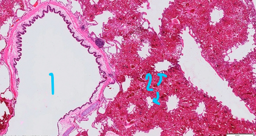 <p>What is 2?</p>