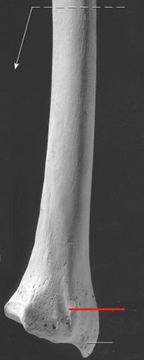 <p>What structure is the arrow pointing to?</p>