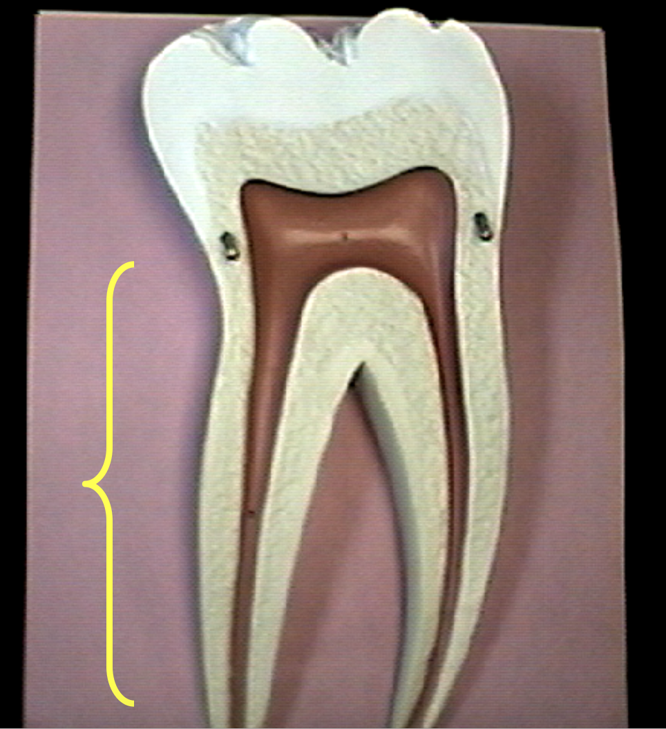 <p>Identify the organs of the digestive tract.</p>