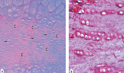 <p>What cartilage type is this?</p>