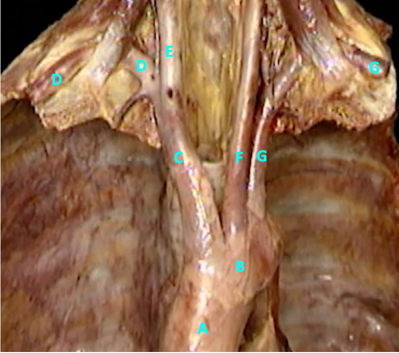 <p>C</p>