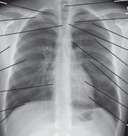 <p>name of this xray</p>
