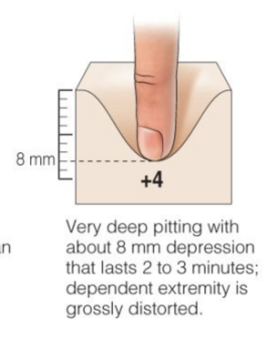 <p>8 mm</p><p>DEep pitting lasts 2-3 min</p>
