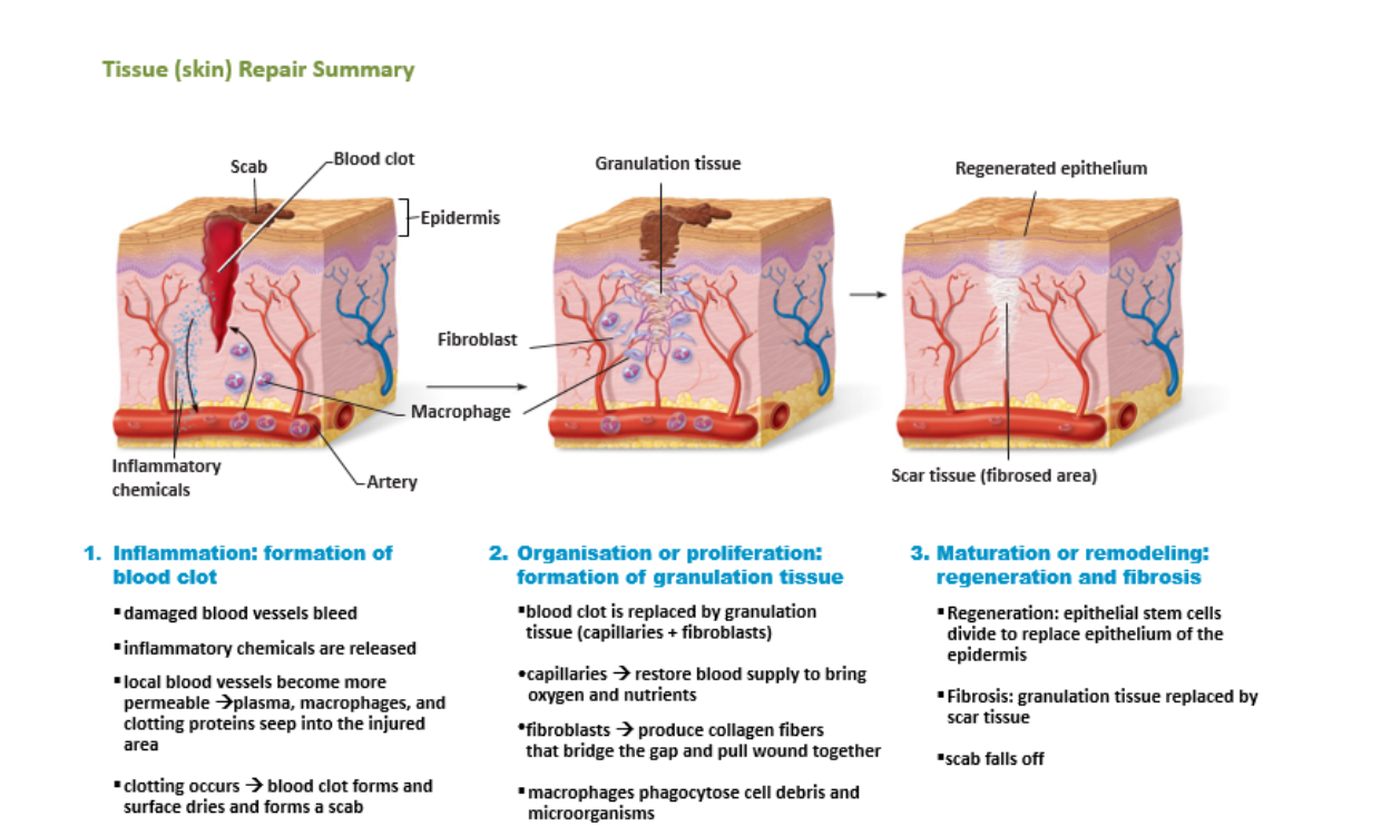 <p><strong>Visible scar</strong></p><ul><li><p>If repair occurs <strong>only by fibrosis</strong></p></li><li><p>Common in <strong>major wounds</strong></p></li></ul><p><strong>Invisible or minimal scar</strong></p><ul><li><p>If repair occurs by <strong>regeneration + fibrosis</strong></p></li></ul><p></p>
