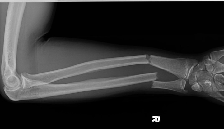 <p>What is the diagnosis?</p>