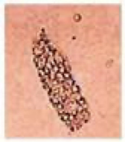 <ul><li><p>Contain small droplets of fat.</p></li><li><p>More commonly seen in cats due to high lipid content of their tubular epithelium.</p></li></ul><p></p>
