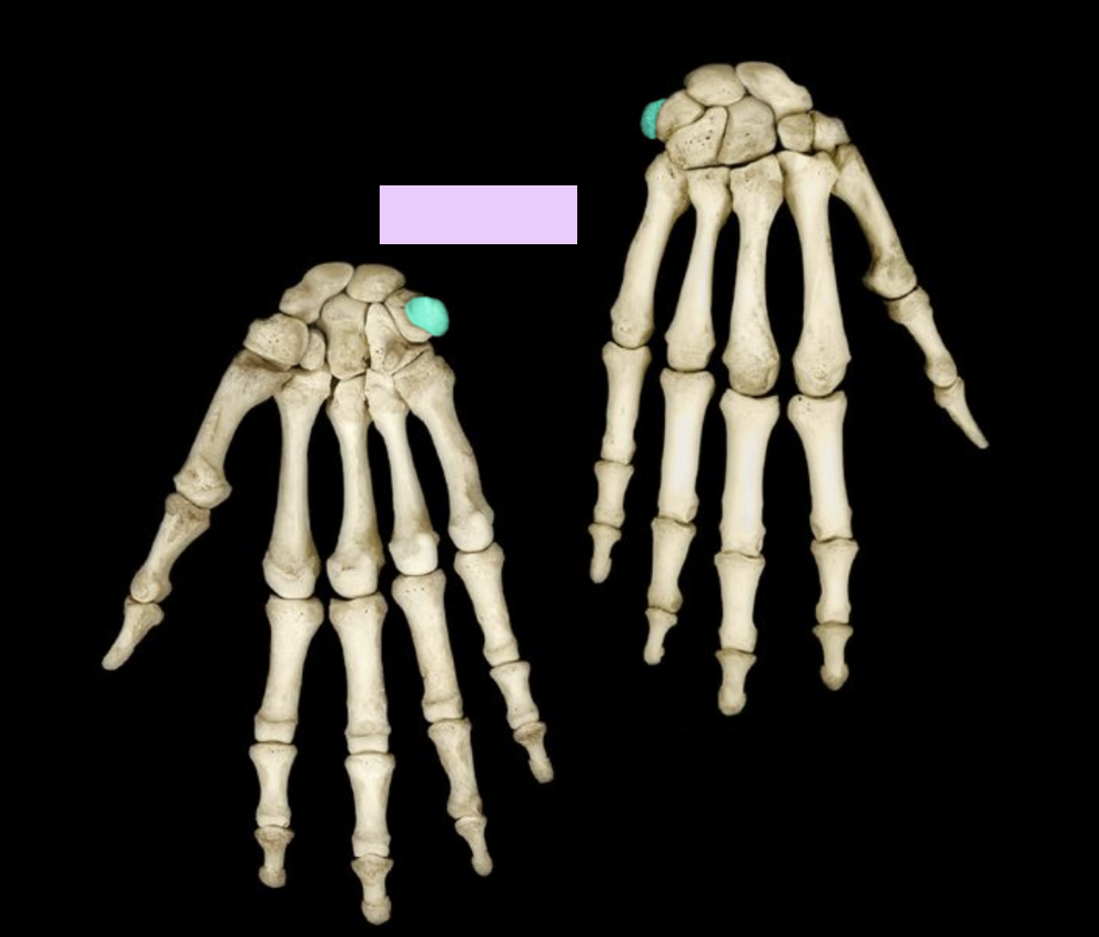 <p>What structure is highlighted?</p>