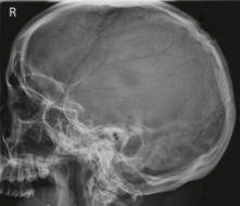 <p><span style="background-color: transparent;">Lateral skull</span></p>