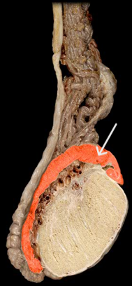 <p>identify the structure highlighted.</p>