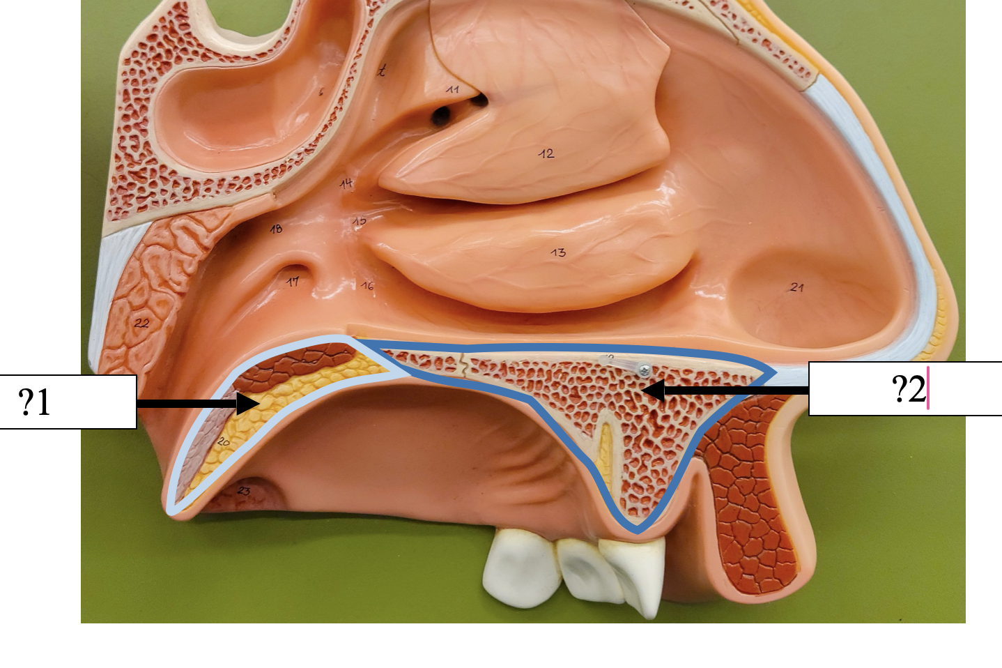 <p>2 Name the bone?</p>