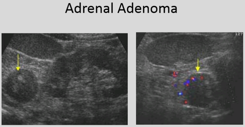 <p>Older patients with diabetes or hypertension</p>