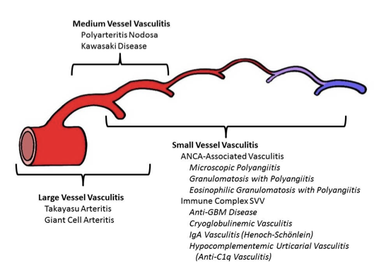<p>Group of vascular disorders that cause inflammatory injury. </p>