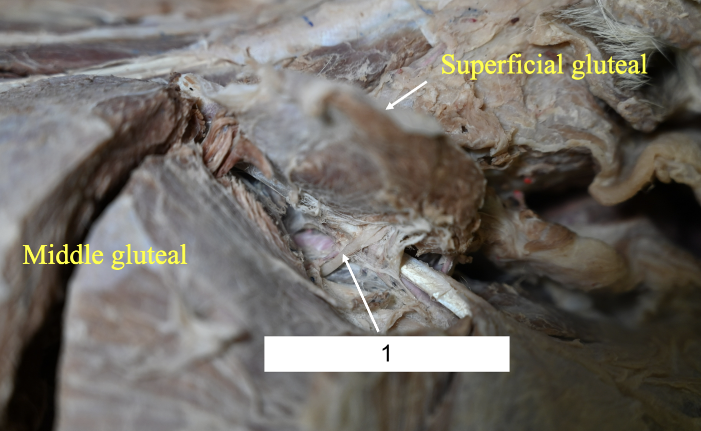 <p>What nerve is 1?</p>