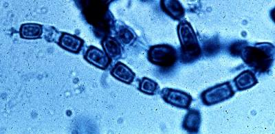 <p>endemic to arid southwest US and mexico. causes valley fever.</p>