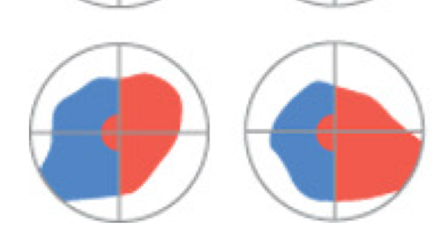 <ul><li><p>differentiates lesions of the optic tract or thalamus from cortical lesions</p><ul><li><p>lesions of occipital lobe will often spare the macula</p></li></ul></li><li><p>macular vision is preserved (spared from damage)</p><ul><li><p>macula = small specialized area of high visual acuity, near retina</p></li></ul></li></ul><p></p><p></p>