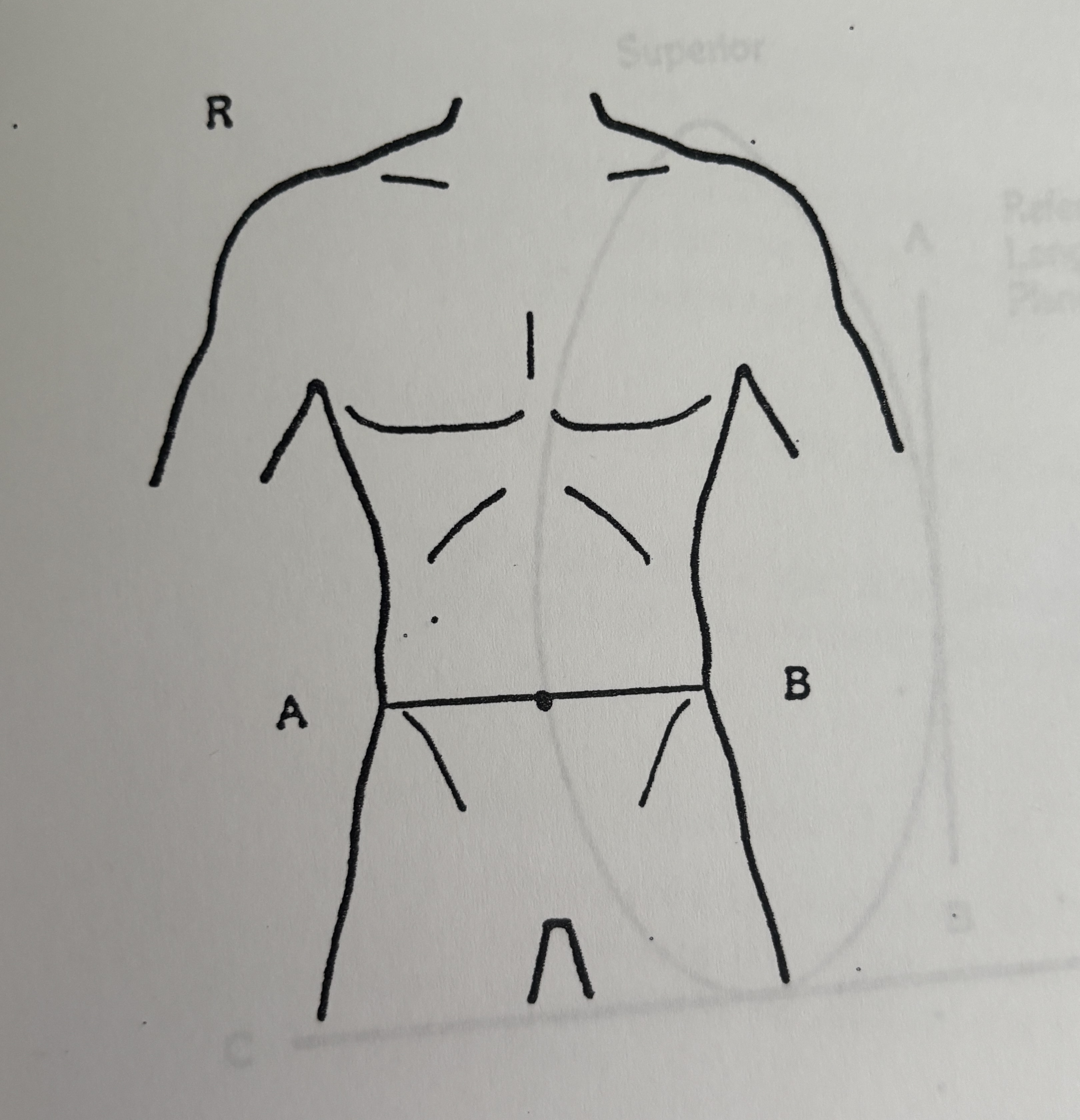 <p>Anatomical plane indicated by line A-B in an image</p>