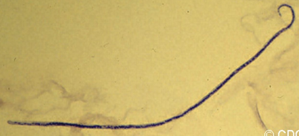 <p>What parasite is this?</p>