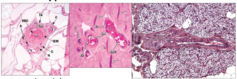<ul><li><p>Smallest arteries; 30–200 μm in diameter</p><ul><li><p>Tunica media = one to a few layers of smooth muscle</p></li><li><p>Tunica externa roughly same size as tunica media</p></li><li><p>Blood flow into capillaries regulated by precapillary sphincters</p><ul><li><p>Arteriovenous anastomosis directly connects arterioles to venules, allows bypass of capillary bed (can be used to regulate body temp</p></li></ul></li></ul></li></ul><p></p>