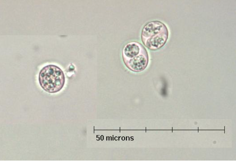 <p>what stage of toxoplasma gondii is shown?</p>