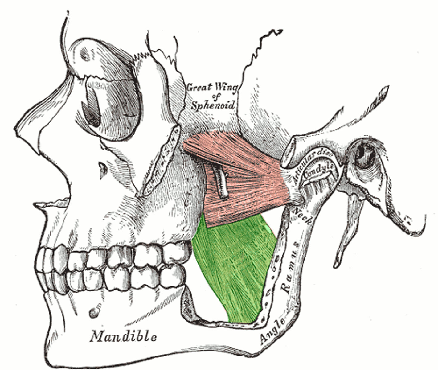 <p>Region:</p><p>Head</p><p>Action:</p><p>Elevates mandible </p><p>Innervation:</p><p>CN V3</p>