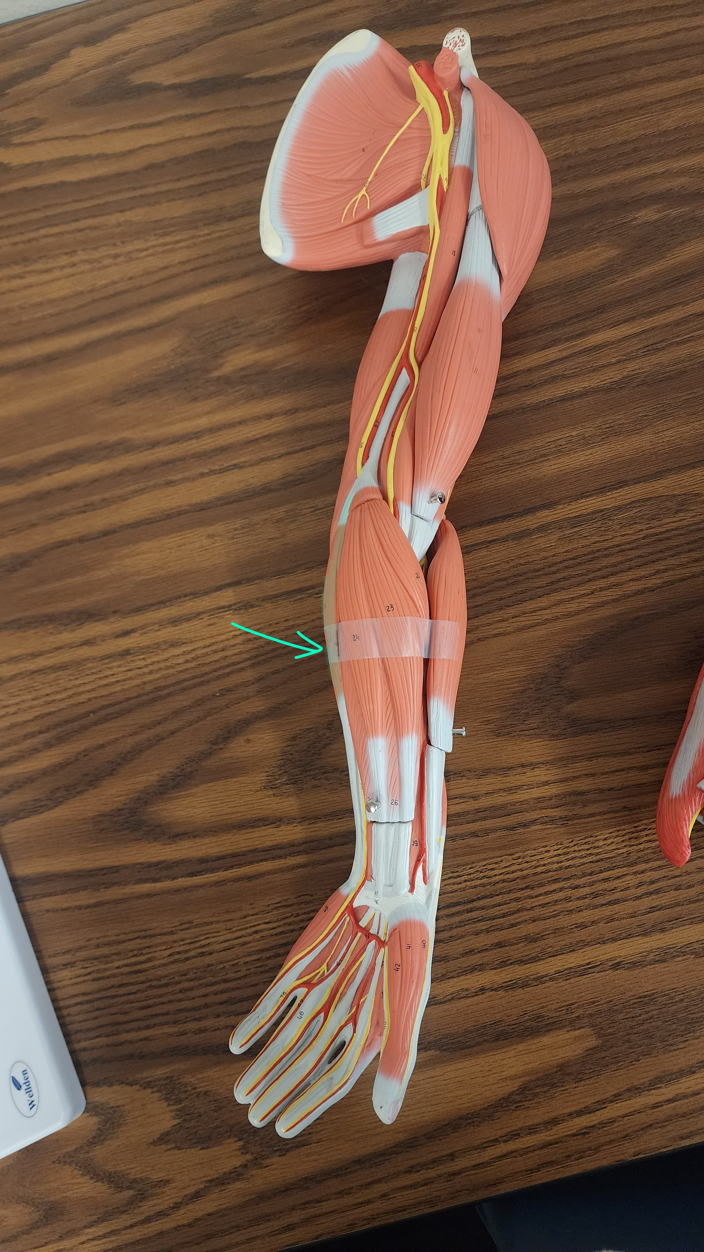 <p>What muscle is this?</p>