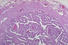 <p>if this organ's epithelium is ciliated simple columnar, name it anatomically</p>