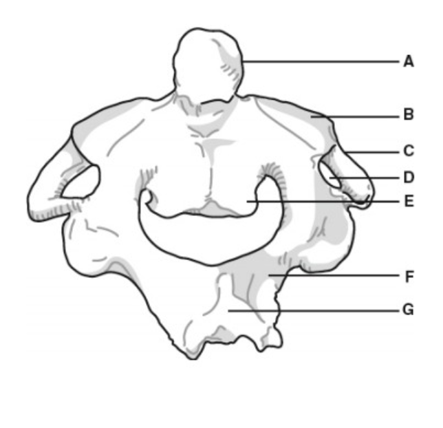 <p>A</p>