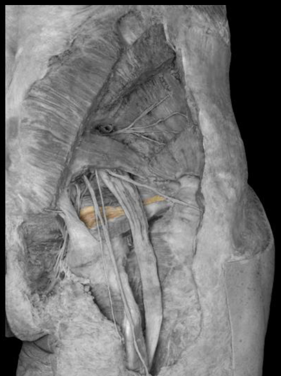 <p>origin of obturator internus</p>