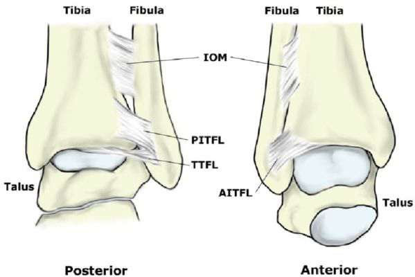 <p></p><ul><li><p>Tibial-Femoral Syndesmosis</p></li><li><p>Anterior-Inferior Tibiofibular Ligament (AITFL)</p></li><li><p>Posterior-Inferior Tibiofibular Ligament (PITFL)</p></li><li><p>Transverse Ligament</p></li></ul><p></p>