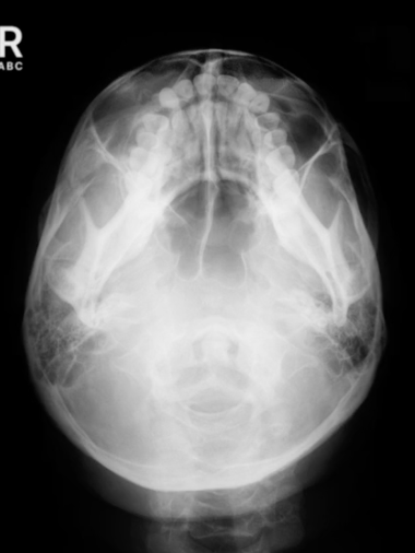 <p>SMV demonstrates:</p>