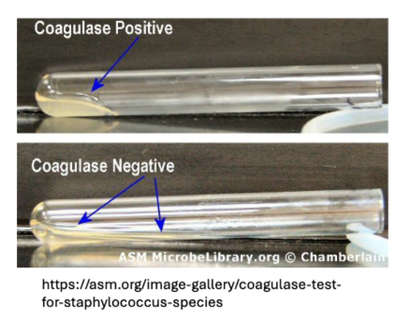 <p>A laboratory test used to differentiate <strong>Staphylococcus aureus</strong> from other staphylococci by detecting the presence of coagulase enzyme, which causes blood plasma to clot. </p><p><strong>A positive result indicates pathogenic potential. </strong></p>