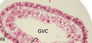 <p>hydra cross section </p>