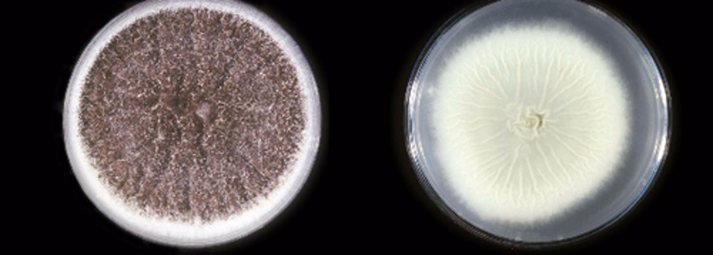 <p>White/yellow, wooly = young</p><p>Black/white, granular = mature</p><p>3 days</p>